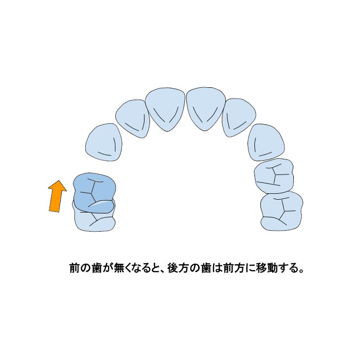 歯の移動