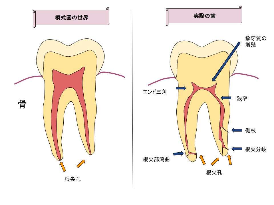 歯の模式図と実際の歯の違い